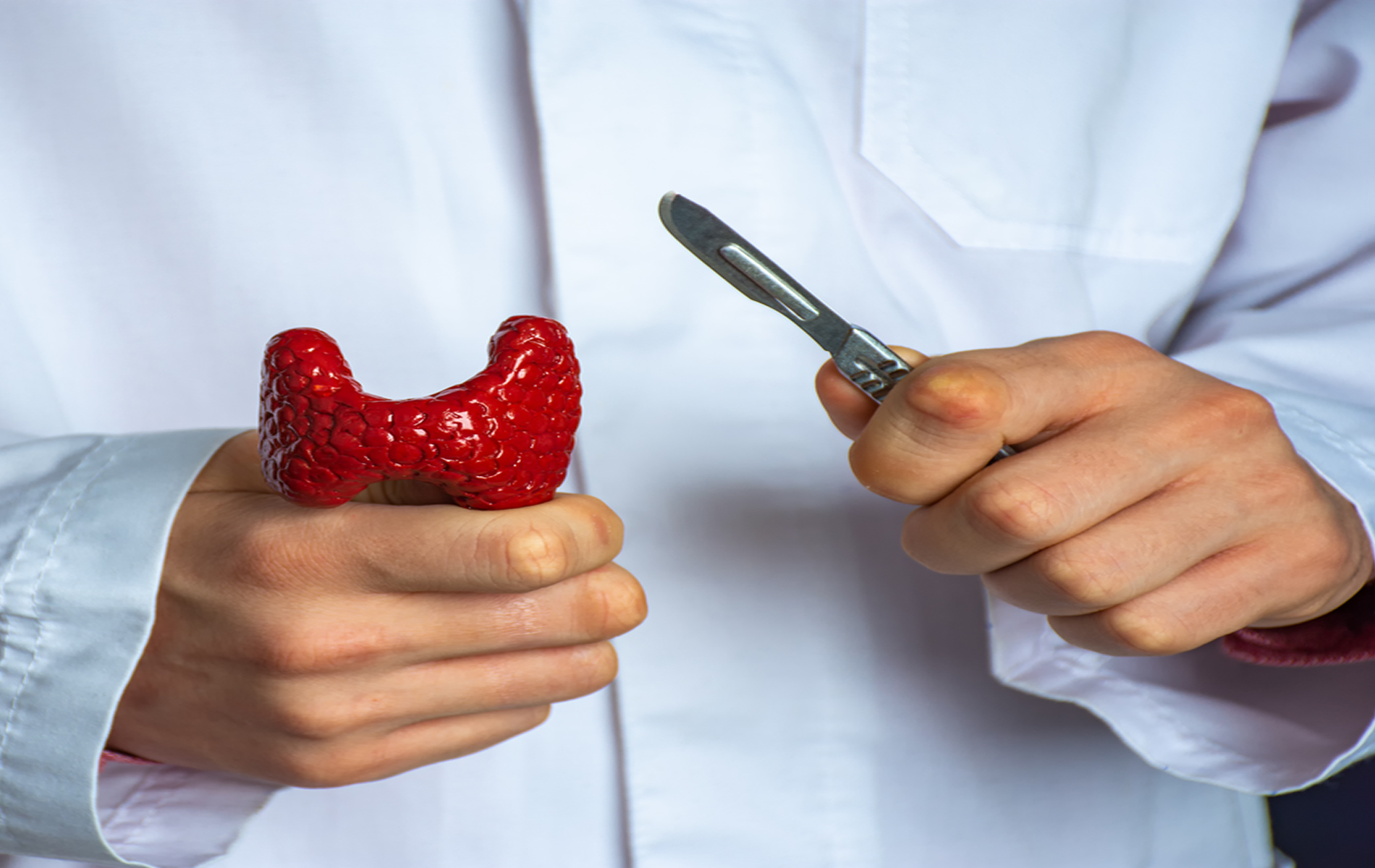 Adipositas: Wie kann ich gesund abnehmen