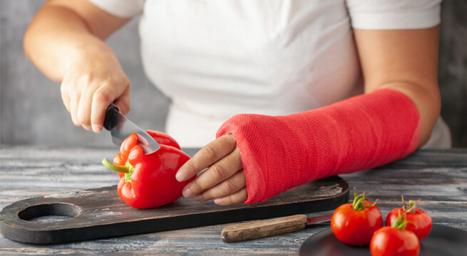 Adiöse Frau schneidet mit eingepipsten Arm eine Paprika